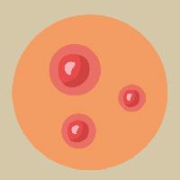 illustration Papule