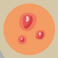 illustration nodule